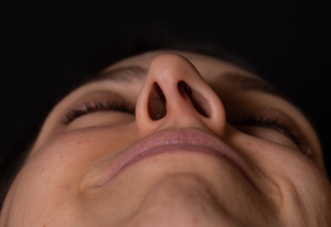 Septum Deviation London