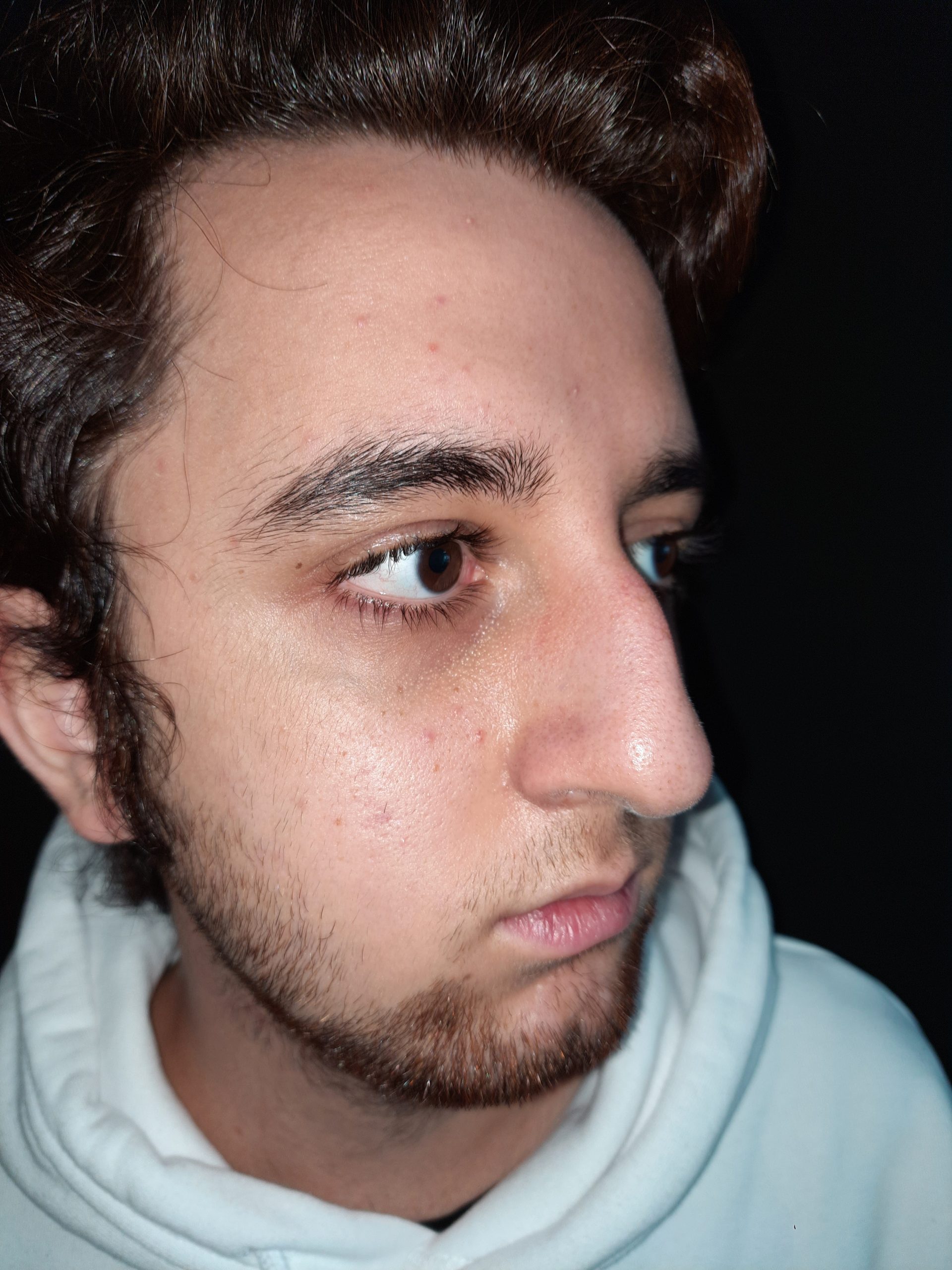 Sonrası