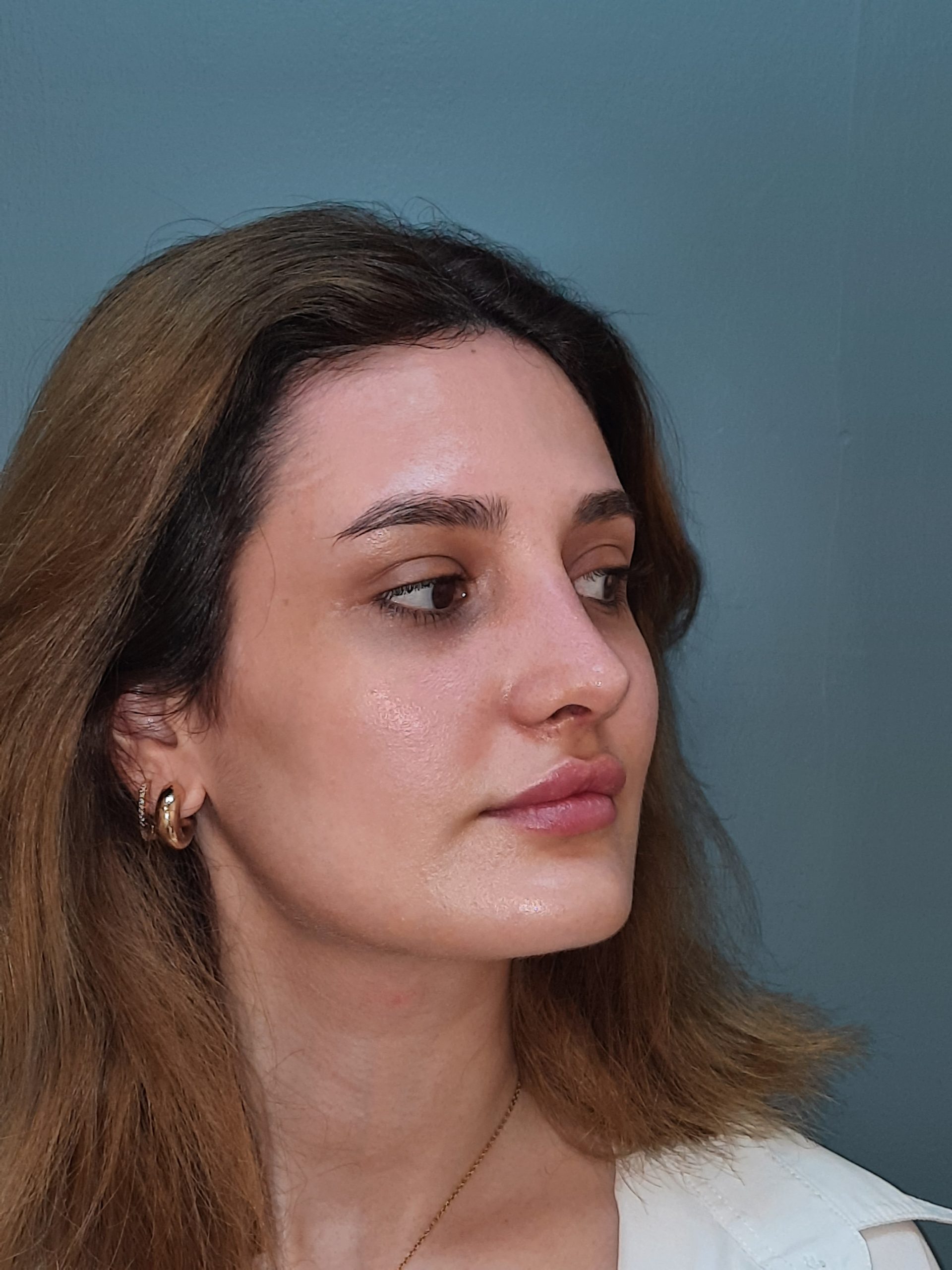 Sonrası