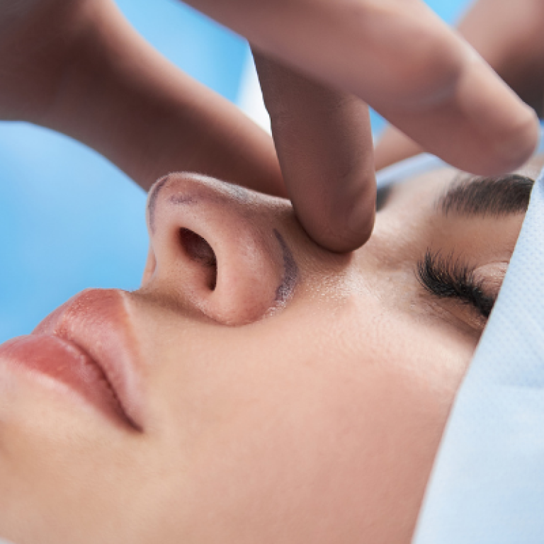 burun-estetigi-yanlis-bilinenler